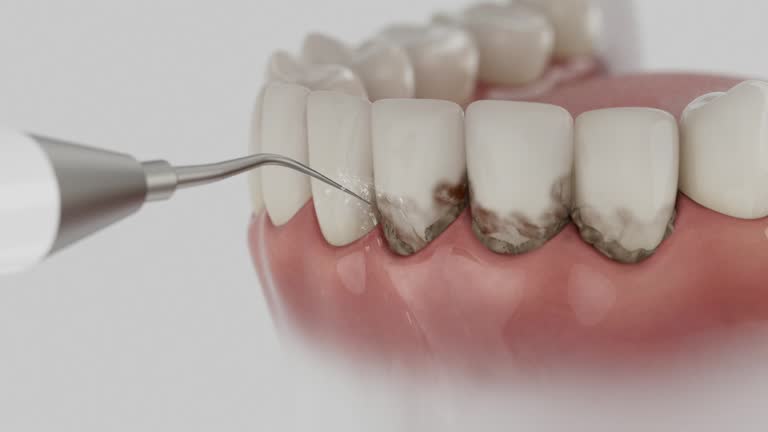 Trusted Invisalign Clear Aligners service in Ama, LA - Dentist Open Now